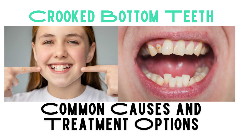 Crooked Bottom Teeth